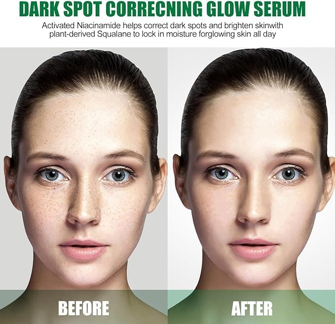 Eelhoe - Dark Spot Correcting Serum