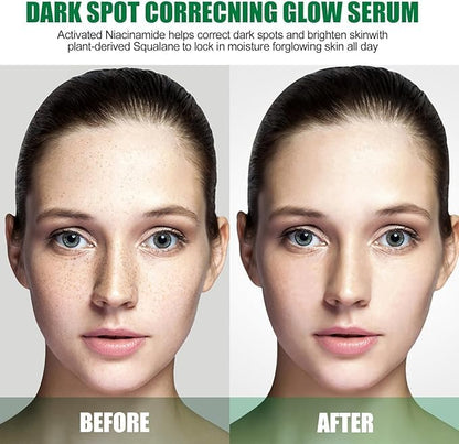 Eelhoe - Dark Spot Correcting Serum