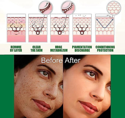 Eelhoe - Dark Spot Correcting Serum