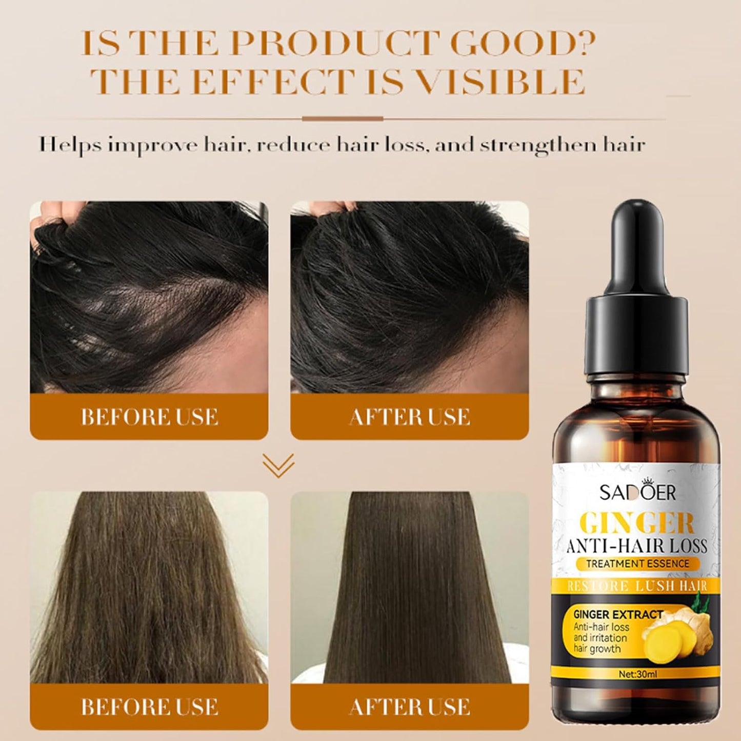 Bioaqua - Acne Removal & Anti Hair Loss